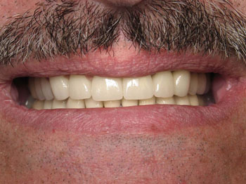 Cosmetic Dentist Fairfield | Family Dentist Fairfield | 203.333.4700