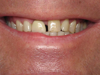 Cosmetic Dentist Fairfield | Family Dentist Fairfield | 203.333.4700